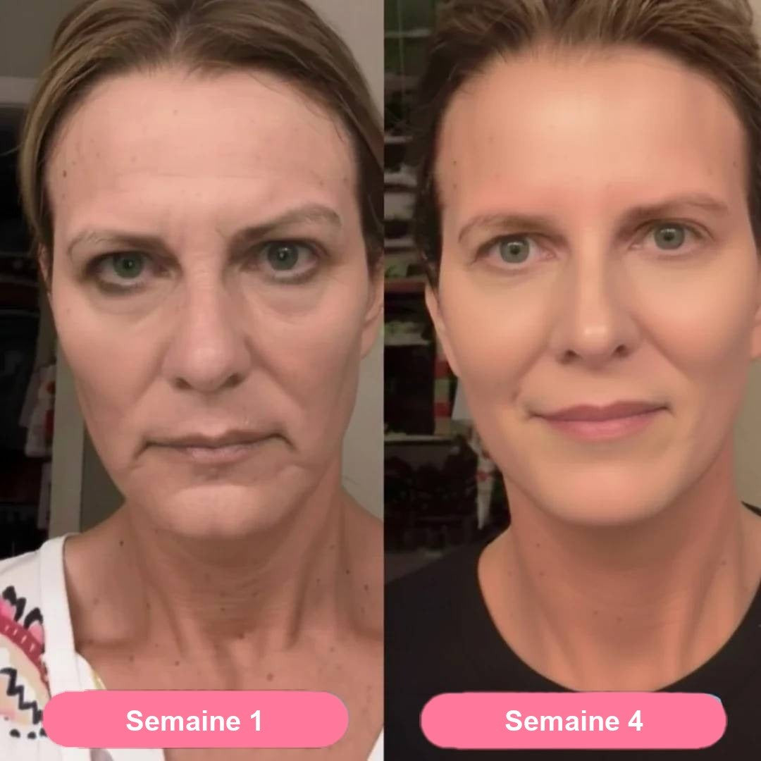 Semana 1 / semana 4