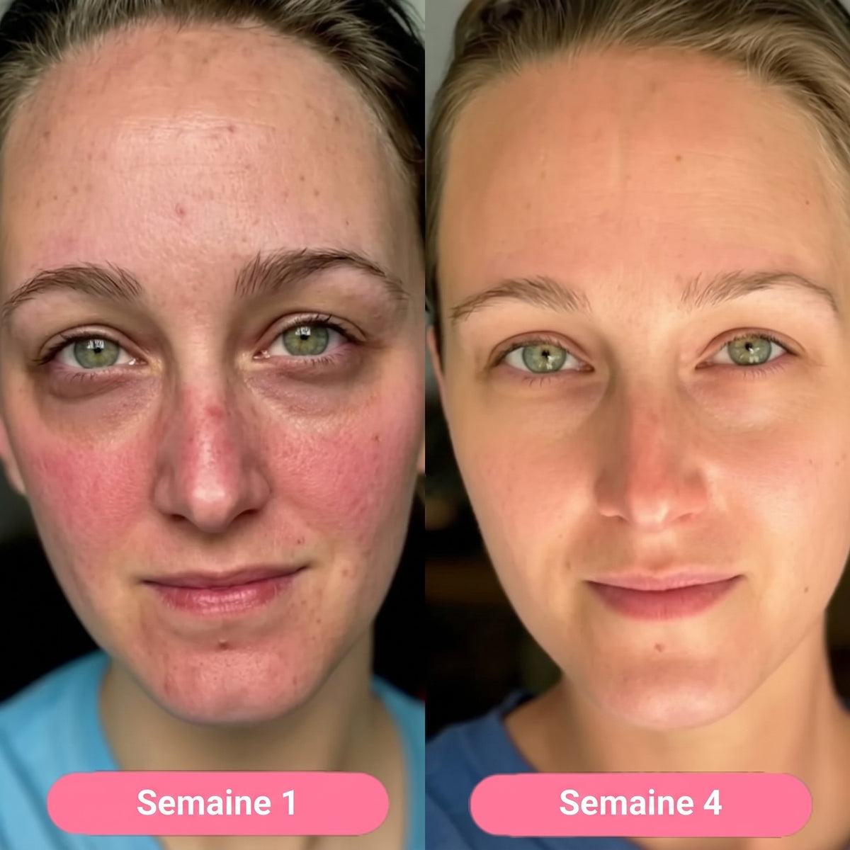 Semana 1 / semana 4