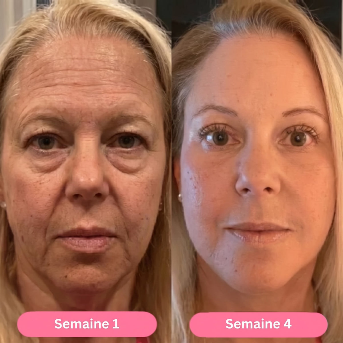 Semana 1 / semana 4
