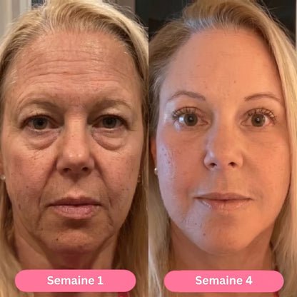 Semana 1 / semana 4