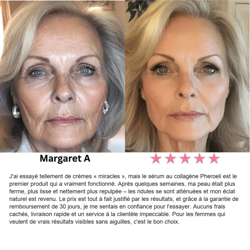Opinión de Margaret A.