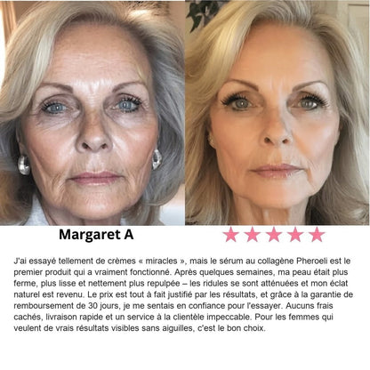 Opinión de Margaret A.